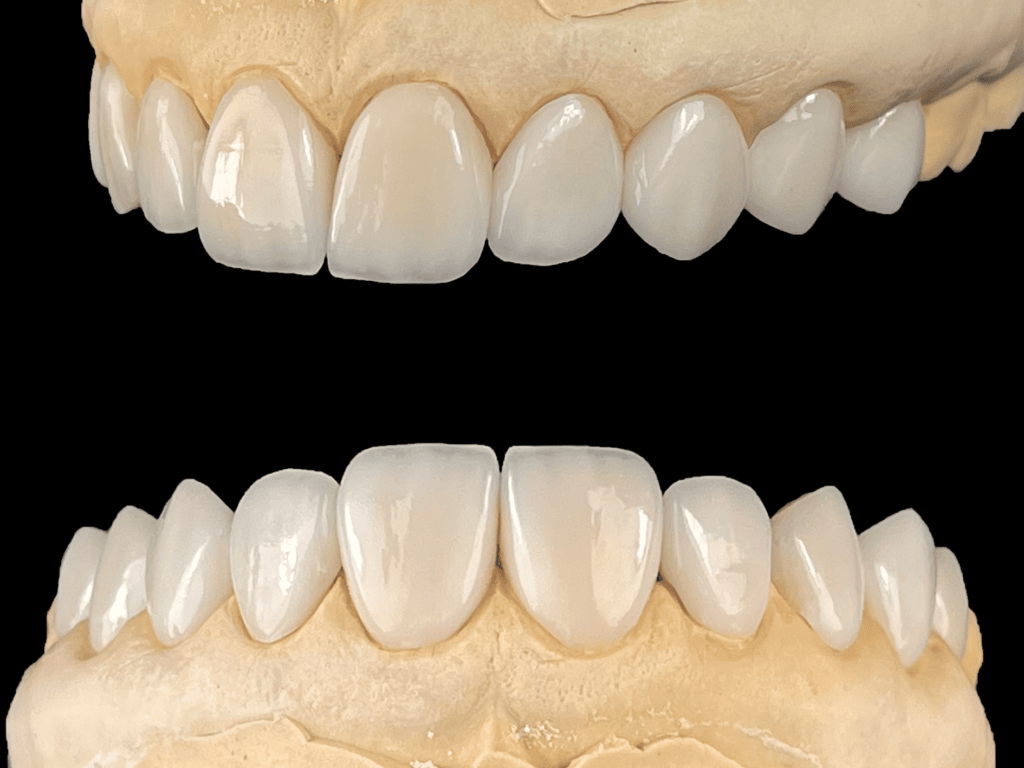 ceramics and zirconia (2)