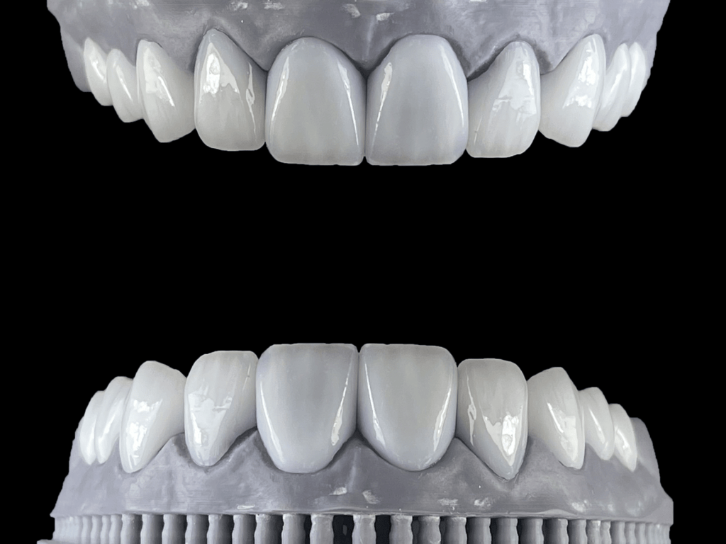 ceramics and zirconia (3)