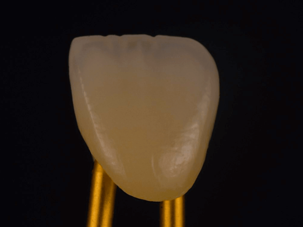 ceramics and zirconia (4)