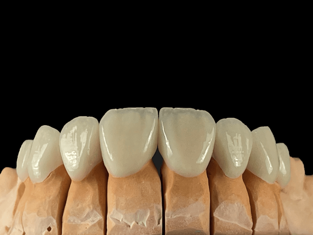 ceramics and zirconia (5)