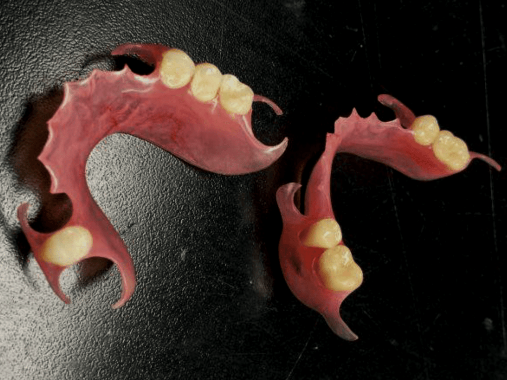 denture