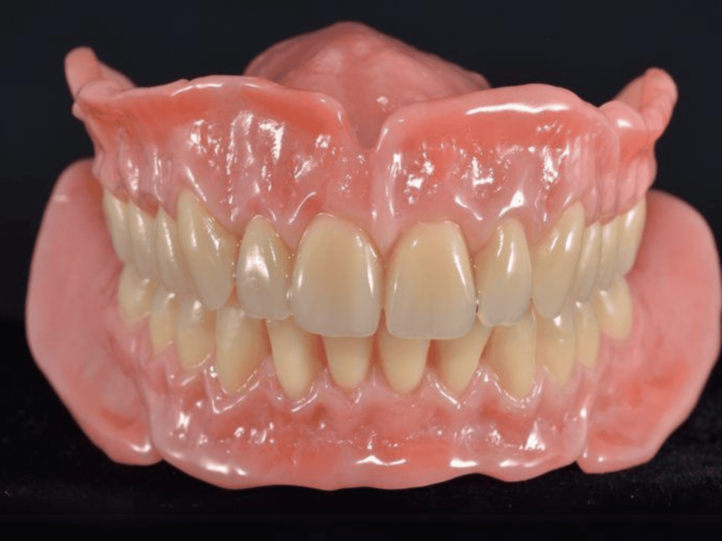 denture (2)