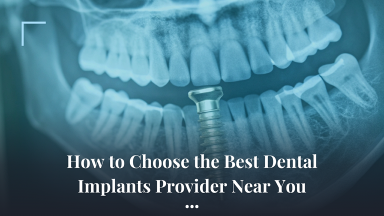 best dental implants
